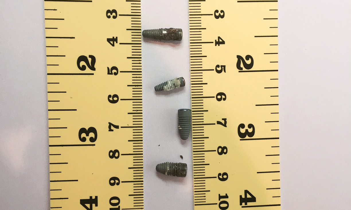 “Orrs.org” Daniel L. Orr II – Implant Disaster