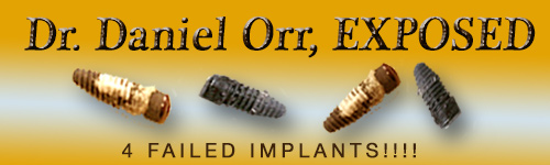 Dr. Daniel Orr, DDS Las Vegas NV Exposed, Unofficial Site by Steve Barket Failed Implants